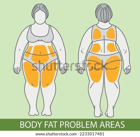 Body fat problem areas. Medical infographic. Healthcare illustration. Vector illustration. 