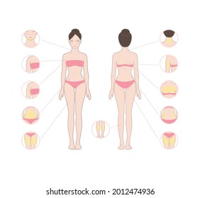 Body Fat Problem Areas Vector