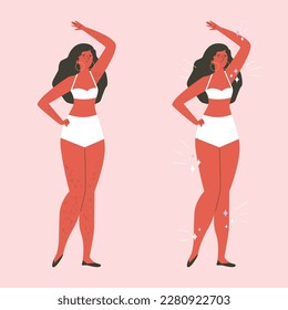 Eliminación de pelo corporal antes y después, mujer feliz - ilustración vectorial plana aislada en fondo rosa. Conceptos de epilación y depilación, afeitado y depilación.