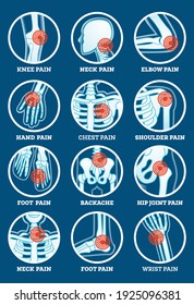 Body Pain Set. Pain In Backache, Hip Joint, Knee, Elbow, Hand, Foot, Shoulder, Neck, Chest And Wrist. Woman's And Man's Body Parts. Vector Illustration. Icons Set.