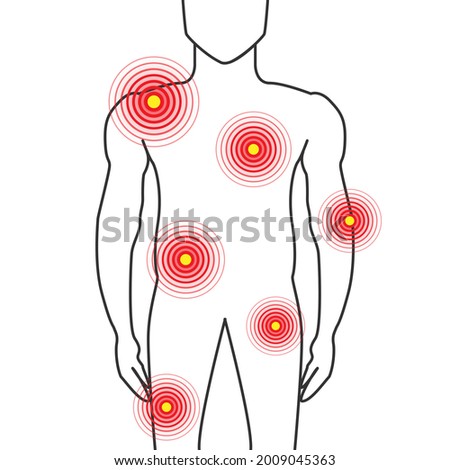 Body Parts Pain Illustration with Shoulders, Chest, Joint, Hips and Muscle Ache on Man 