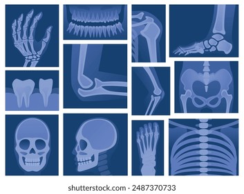 Body parts scanning. X ray skeleton human body medical scan of bones skull legs arms knees exact vector concept pictures