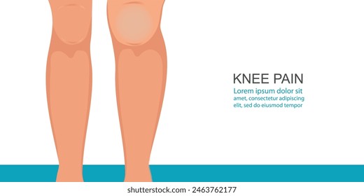 Body people with leg and Knee pain symptoms, muscle pain tendon inflammation or gout symptoms and bone degeneration osteoarthritis, vector illustration.