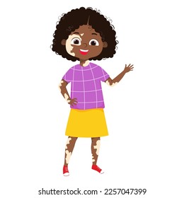 Ilustración corporal positiva de una feliz niña afroamericana con síndrome de vitiligo. Ilustración vectorial de dibujos animados
