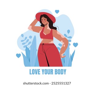 Body positive woman. Young girl with vitiligo. Love your body inscription. Beauty, aesthetics and elegance. African american person. Flat vector illustration isolated on white background