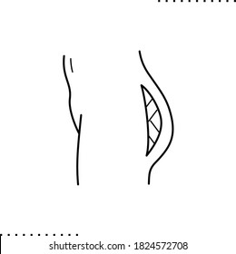 Body shape correction, buttock augmentation, Brazilian Butt Lift  vector icon in outlines