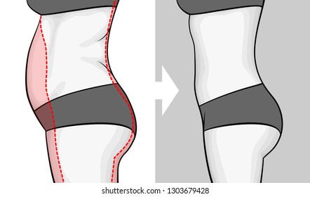 The body of a woman before and after losing weight. Belly view from side. Red outline showing excess weight. svg