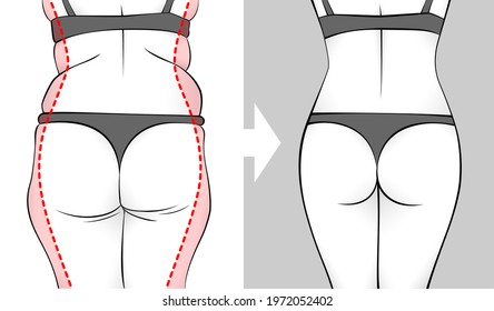 The body of a woman before and after losing weight. Back, butt and hips. Red outline showing overweight.	