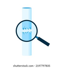 Bone Fracture Injury Broken Crack Leg by Low Bone Density or Osteoporosis Flat Vector Medical Illustration