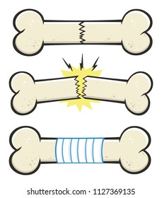 Bone Fracture Line Cartoon Drawing Design Set 2. Vector Collection Isolated On White Background
