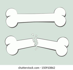 bone fracture vector illustration