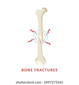 bone fractures vector design illustration