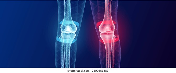 Bone healthy and arthritis knee joint inside leg cartilage becomes worn this results swelling. Future technology cure pain and red blue arrows surround. Bone low poly triangle with copy space for text