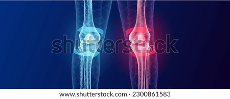 Bone healthy and arthritis knee joint inside leg cartilage becomes worn this results swelling. Future technology cure pain and red blue arrows surround. Bone low poly triangle with copy space for text