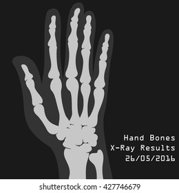 Bone illustration in vector