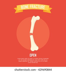 Bone illustration in vector