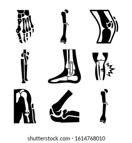 bone joints icon isolated sign symbol vector illustration - Collection of high quality black style vector icons
