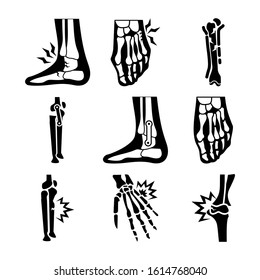 bone joints icon isolated sign symbol vector illustration - Collection of high quality black style vector icons
