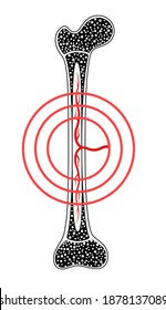 Icono o logotipo anatómico de la médula ósea. Estructura ósea humana. Investigación de laboratorio, pruebas, cirugía y exámenes médicos. Esclarecimiento humano x raya. Afiche médico para la clínica. Ilustración vectorial plana aislada
