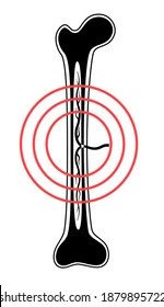 Icono o logotipo anatómico de la médula ósea. Estructura ósea humana. Investigación de laboratorio, pruebas, cirugía y exámenes médicos. Esclarecimiento humano x raya. Afiche médico para la clínica. Ilustración vectorial plana aislada
