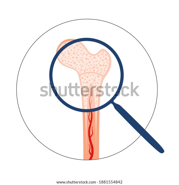 Bone marrow anatomical icon or logo. Human\
bone structure. Laboratory research, tests, surgery and medical\
exam. Human skeleton x ray scan. Medical poster for clinic.\
Isolated flat vector\
illustration