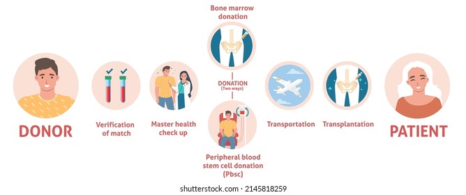 Bone Marrow Donation And Transplantation. Blood Stem Cell Donate After Verification Wit Patient Health Indicator. Medical Poster Infographic