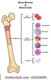 Bone Marrow infographic diagram including femur reproduction of red white blood cells platelets lymphocyte monocyte esinophill basophill neurophill for medical science education