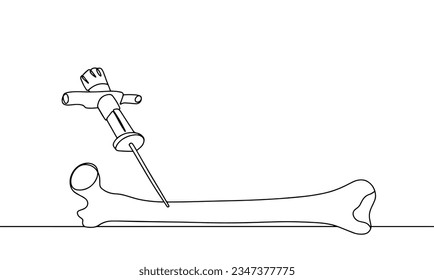 Bone marrow puncture from a human femur. Bone needle. World Marrow Donor Day. One line drawing for different uses. Vector illustration.