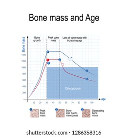Bone mass for male and female. Age and osteoporosis. Chart. healthy lifestyle. Vector illustration for educational, science and medical use