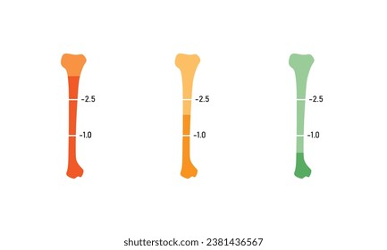 Bone Mineral Density Level Concept Design. Vector Illustration.	