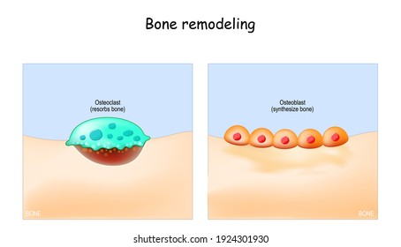 Bone Remodeling. Close-up Of A Osteoclast Resorbs Bone, And Osteoblasts Synthesized Bone Tissue. Vector Illustration