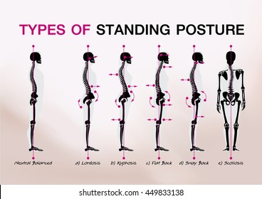 Bone Standing Posture All