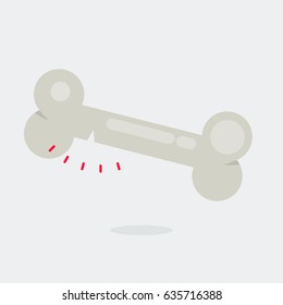  Bone vector illustration: Osteoporosis