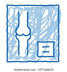 Bone X-ray Image Of Human Joints Orthopedic sketch icon vector. Hand drawn blue doodle line art isolated symbol illustration