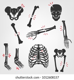 Bones Fractures Icons. Flat vector illustrations isolated on a white background. Broken skull, ribs, thigh, foot, pelvis, femur, hand palm, etc