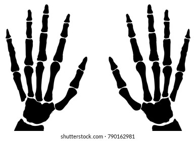 The bones of the hand x-ray isolated on a white background