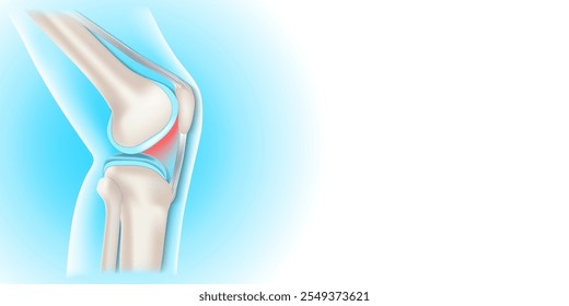Bones of Knee joint on blue and white background with copy space for your text. Side view of human knee. Vector illustration for presentation, advertising, banner, visiting card
