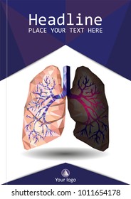 Book cover design low poly realistic human lungs and bronchus with cancer inflammation disease. Smoker's lungs banner, brochure, flyer, poster. Vector.