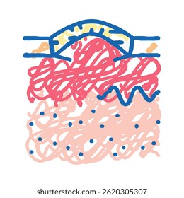 boxcar acne scar doodle icon sketch vector. boxcar acne scar sign. isolated symbol illustration