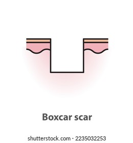 Boxcar scar, atrophic scar, type of acne scar on skin surface with color and line vector isolated on white background. Skin care and beauty concept. Flat icon illustration.