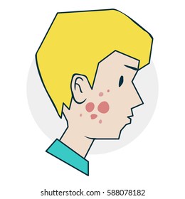 The boy allergies or acne