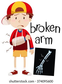 Boy With Broken Bone And X-ray Illustration