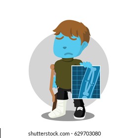 boy with broken leg showing his x-ray result