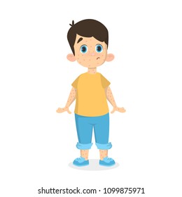 Boy with chickenpox standing on white background.