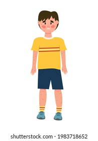 boy with chickenpox. The whole body is covered with red spots, rashes, allergies. Skin disease. The isolated image on a white background. Vector illustration. Cartoon character.