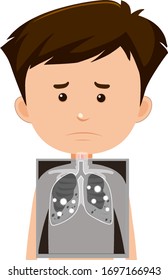 Chico con ilustración de rayos x pulmonar
