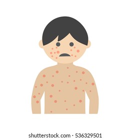 Boy with Measles