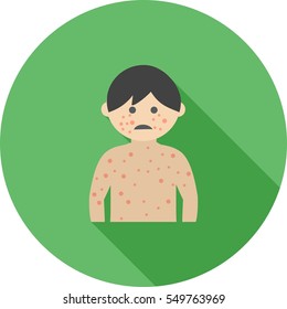 Boy with Measles