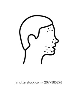 Boy With Pimples On Face Line Icon. Man With Blackhead, Acne, Rash Linear Pictogram. Dermatologic Problem, Allergy, Inflammation Skin Outline Icon. Editable Stroke. Isolated Vector Illustration.