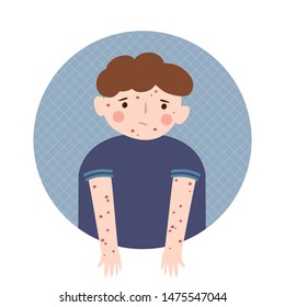 Boy With A Rash On The Body. Chickenpox, Measles, Rubella, Allergy. Vector Illustration In Cartoon Style